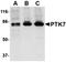 Protein Tyrosine Kinase 7 (Inactive) antibody, orb74870, Biorbyt, Western Blot image 