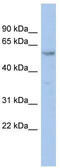 Zinc Finger Protein 8 antibody, TA333730, Origene, Western Blot image 