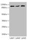 DEAD-Box Helicase 20 antibody, orb39460, Biorbyt, Western Blot image 