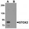 Storkhead Box 2 antibody, MBS151556, MyBioSource, Western Blot image 