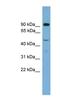 Zinc finger Y-chromosomal protein 2 antibody, NBP1-91542, Novus Biologicals, Western Blot image 