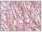 Desmin antibody, MA5-15306, Invitrogen Antibodies, Immunohistochemistry frozen image 