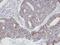 Actin Related Protein 2/3 Complex Subunit 3 antibody, LS-C185451, Lifespan Biosciences, Immunohistochemistry frozen image 