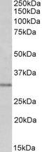 Msh Homeobox 1 antibody, GTX89726, GeneTex, Western Blot image 