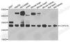 COP9 Signalosome Subunit 7A antibody, A8212, ABclonal Technology, Western Blot image 