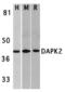 Death Associated Protein Kinase 2 antibody, A02241, Boster Biological Technology, Western Blot image 