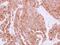 Hypoxanthine Phosphoribosyltransferase 1 antibody, GTX101148, GeneTex, Immunohistochemistry paraffin image 