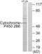 Cytochrome P450 Family 2 Subfamily B Member 6 antibody, abx013983, Abbexa, Western Blot image 