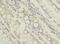 T Cell Leukemia Translocation Altered antibody, A63552-100, Epigentek, Immunohistochemistry paraffin image 