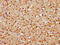 Cullin Associated And Neddylation Dissociated 1 antibody, CSB-PA774815LA01HU, Cusabio, Immunohistochemistry paraffin image 