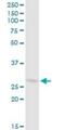 COP9 Signalosome Subunit 7B antibody, H00064708-B01P, Novus Biologicals, Western Blot image 