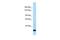 Collagen Type XXI Alpha 1 Chain antibody, PA5-45317, Invitrogen Antibodies, Western Blot image 