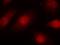 RB Transcriptional Corepressor 1 antibody, P00039, Boster Biological Technology, Immunofluorescence image 