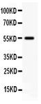 Somatostatin Receptor 2 antibody, LS-C312843, Lifespan Biosciences, Western Blot image 