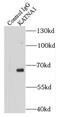 Katanin Catalytic Subunit A1 antibody, FNab04469, FineTest, Immunoprecipitation image 