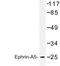 Ephrin A5 antibody, LS-C177019, Lifespan Biosciences, Western Blot image 