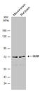 Galactosidase Beta 1 antibody, GTX134513, GeneTex, Western Blot image 