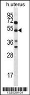 Actin Binding Rho Activating Protein antibody, 56-676, ProSci, Western Blot image 