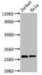 Hydroxysteroid 17-Beta Dehydrogenase 10 antibody, CSB-PA860776HA01HU, Cusabio, Western Blot image 