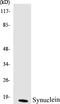 Synuclein Alpha antibody, EKC1557, Boster Biological Technology, Western Blot image 