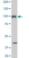 VPS11 Core Subunit Of CORVET And HOPS Complexes antibody, H00055823-M01, Novus Biologicals, Western Blot image 