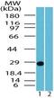 Ubiquitin C-Terminal Hydrolase L1 antibody, PA1-41464, Invitrogen Antibodies, Western Blot image 