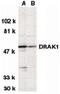 Serine/Threonine Kinase 17a antibody, PA5-19926, Invitrogen Antibodies, Western Blot image 