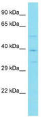 Von Willebrand Factor C Domain Containing 2 antibody, TA331518, Origene, Western Blot image 