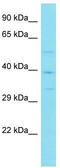 Von Willebrand Factor C Domain Containing 2 antibody, TA331518, Origene, Western Blot image 