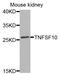 TNF Superfamily Member 10 antibody, LS-C331936, Lifespan Biosciences, Western Blot image 