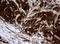 NME/NM23 Nucleoside Diphosphate Kinase 1 antibody, LS-C175576, Lifespan Biosciences, Immunohistochemistry paraffin image 