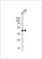 Kruppel Like Factor 4 antibody, PA5-35303, Invitrogen Antibodies, Western Blot image 