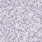 HPS4 Biogenesis Of Lysosomal Organelles Complex 3 Subunit 2 antibody, HPA050189, Atlas Antibodies, Immunohistochemistry frozen image 