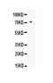 Matrix Metallopeptidase 2 antibody, A00286, Boster Biological Technology, Western Blot image 