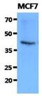 FKBP Prolyl Isomerase 6 antibody, GTX53716, GeneTex, Western Blot image 