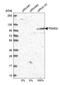 Probable 26S protease regulatory subunit 10B antibody, NBP1-92291, Novus Biologicals, Western Blot image 