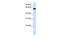 Heparan Sulfate 6-O-Sulfotransferase 3 antibody, GTX46134, GeneTex, Western Blot image 