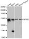 Nuclear Factor Kappa B Subunit 2 antibody, LS-C746896, Lifespan Biosciences, Western Blot image 
