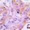 Mitochondrial import receptor subunit TOM34 antibody, LS-C668257, Lifespan Biosciences, Immunohistochemistry paraffin image 