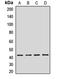 Gastrin Releasing Peptide Receptor antibody, LS-C667809, Lifespan Biosciences, Western Blot image 