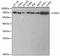 Checkpoint Kinase 2 antibody, A2145, ABclonal Technology, Western Blot image 