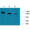 Poly(ADP-Ribose) Polymerase 1 antibody, SMC-259D-A594, StressMarq, Western Blot image 