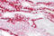 Cadherin 16 antibody, ARP41541_P050, Aviva Systems Biology, Immunohistochemistry paraffin image 