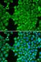 Carbonic Anhydrase 3 antibody, LS-C748523, Lifespan Biosciences, Immunofluorescence image 