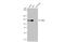 BAF Chromatin Remodeling Complex Subunit BCL11A antibody, GTX03253, GeneTex, Western Blot image 