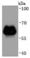 Adrenoceptor Beta 2 antibody, NBP2-67187, Novus Biologicals, Western Blot image 