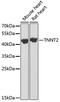 Troponin T2, Cardiac Type antibody, GTX64380, GeneTex, Western Blot image 