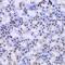 Casein Kinase 1 Epsilon antibody, GTX55549, GeneTex, Immunohistochemistry paraffin image 