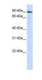 Proprotein Convertase Subtilisin/Kexin Type 5 antibody, orb330310, Biorbyt, Western Blot image 