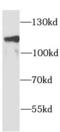 Adaptor Related Protein Complex 2 Subunit Alpha 1 antibody, FNab00323, FineTest, Western Blot image 